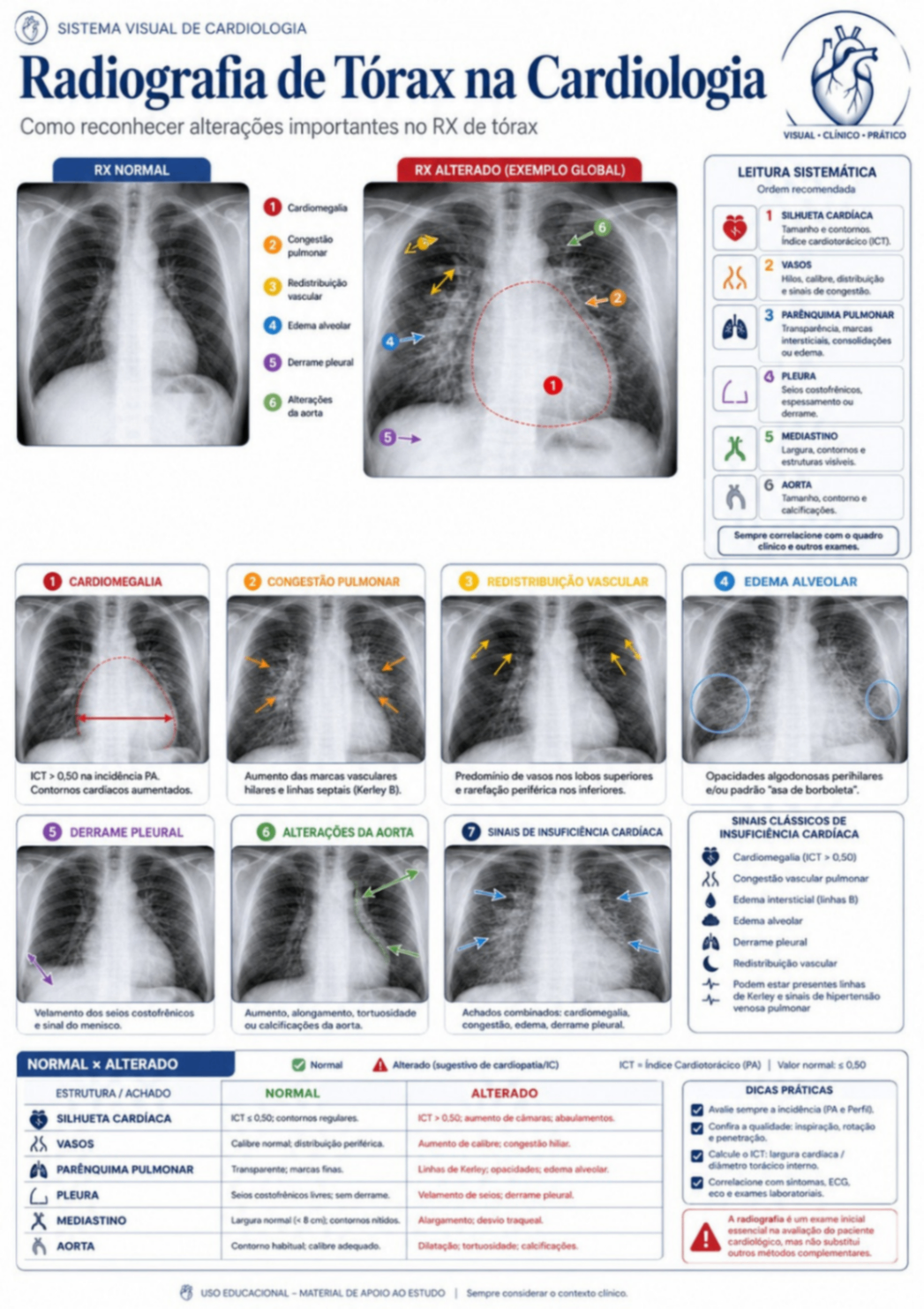 Radiografia de Tórax na Cardiologia